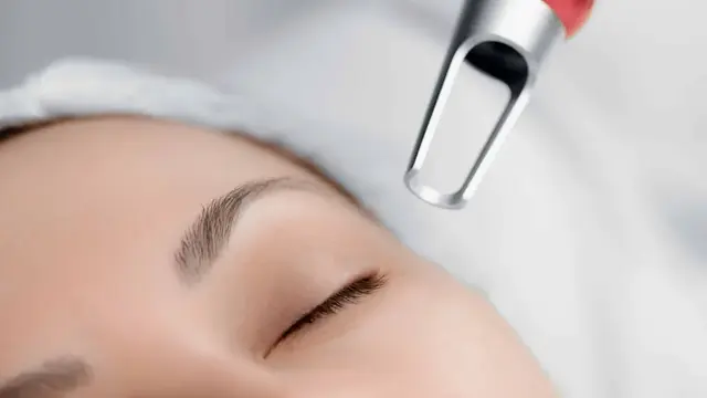 Kenali Perbedaan Laser Treatment: Mana yang Cocok untuk Masalah Kulitmu?
